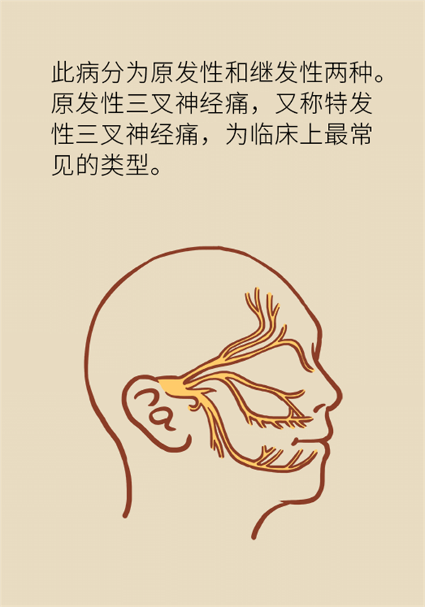這種疼痛不是牙疼？緩解三叉神經(jīng)痛就用這兩招