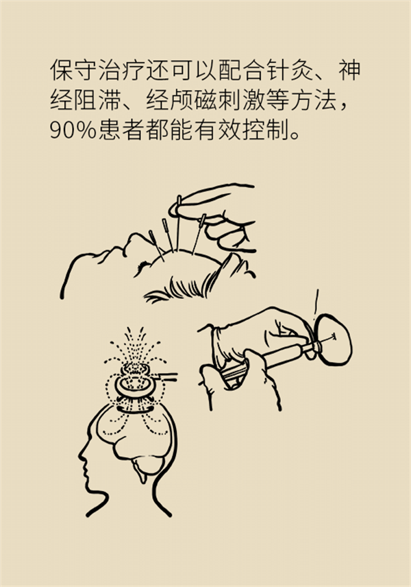 這種疼痛不是牙疼？緩解三叉神經(jīng)痛就用這兩招