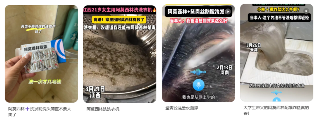 用阿莫西林洗頭，能治療脫發(fā)？別信！